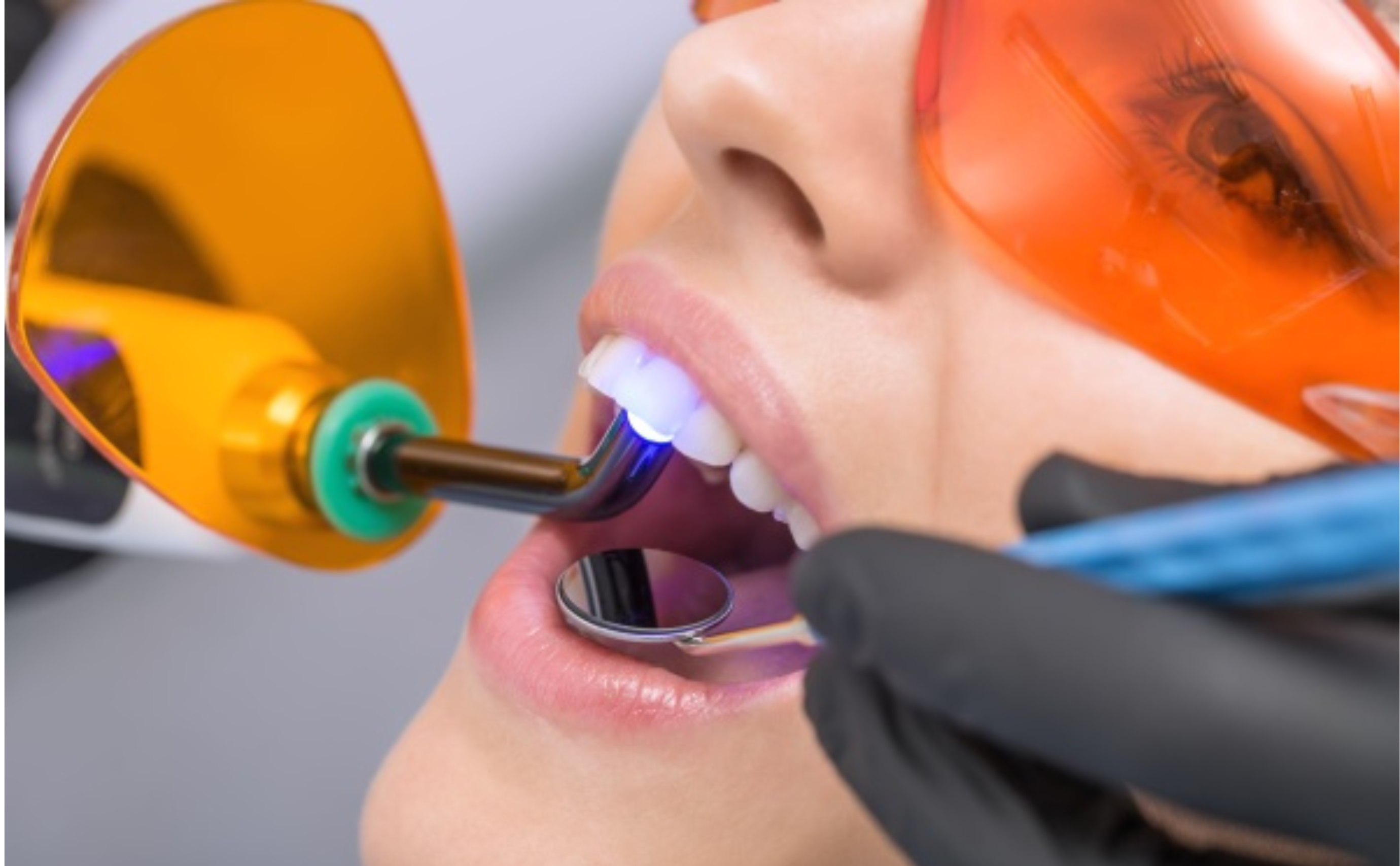 Experienced dentists providing laser dental care in Bachupally