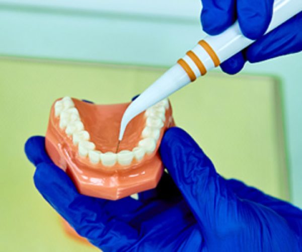 dentures and implant services in bachupally